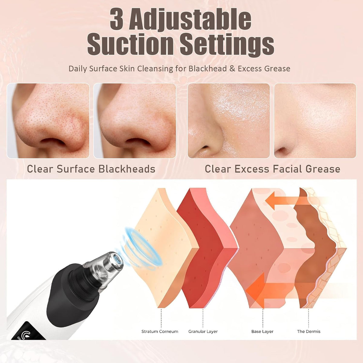 Facial Pore Vacuum with 5 Probes, Black