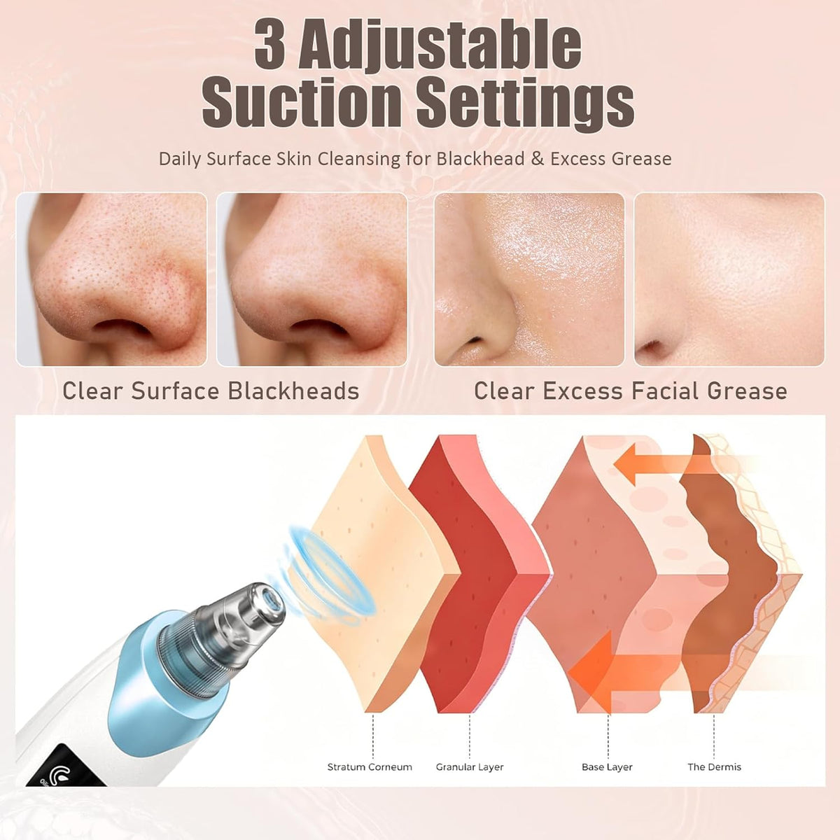Facial Pore Vacuum with 5 Probes, Blue